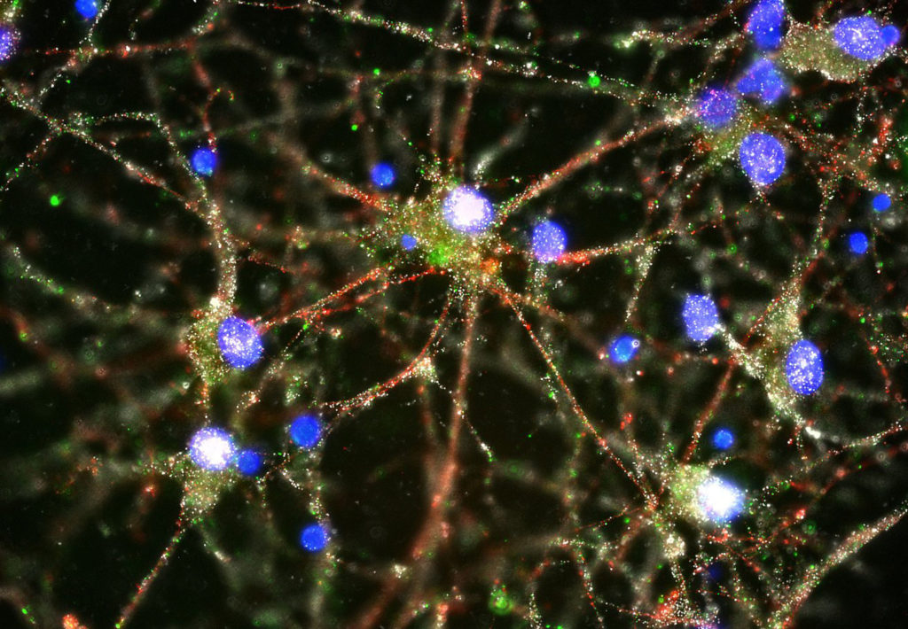 Una imagen de un microscopio de fluorescencia que muestra proteínas C4, en verde, que se encuentra en las sinapsis en un cultivo de neuronas humanas. Heather de Rivera / Mccarroll Lab / Harvard