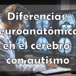 Diferencias neuroanatómicas