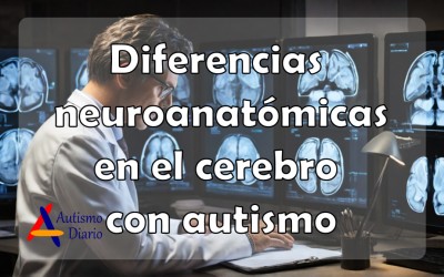 Diferencias neuroanatómicas
